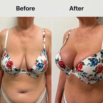 Restore Lift & Volume to Sagging Breasts in Just 14 Days