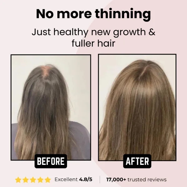 Zephta® H-Regrow 2.0